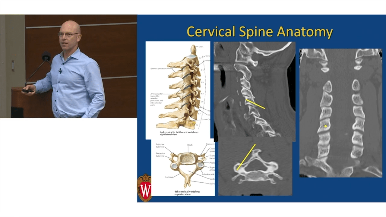 An image from the Lateral Mass Fixation - Seth K,. Williams, M.D. with the University of Wisconsin School of Medicine & Public Health" video on the JnJInstitute.com website.