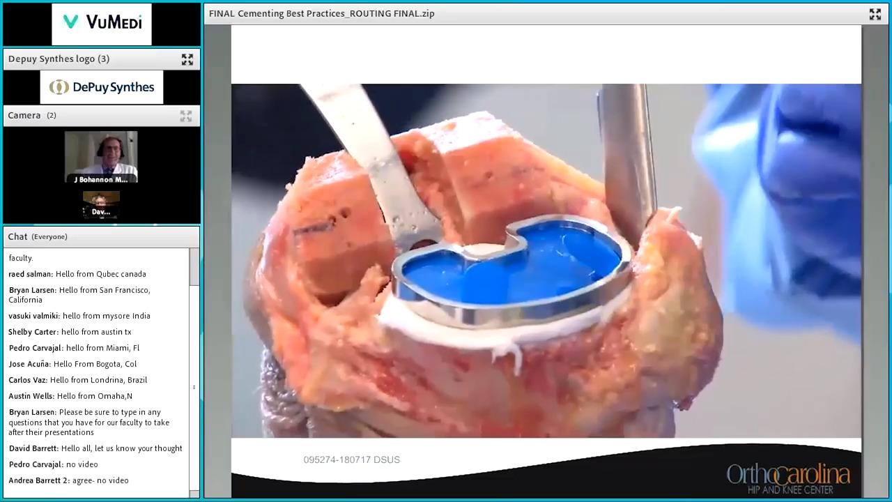 Cementing Best Practices in Total Knee Arthroplasty