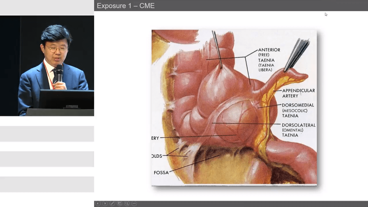 Lateral Node Dissection for Central Obesity Patients with Kil Yeon Lee, MD