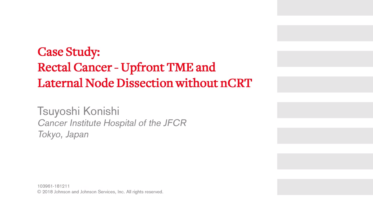 Rectal Cancer - Upfront TME and Laternal Node Dissection without nCRT with Tsuyoshi Konishi, MD