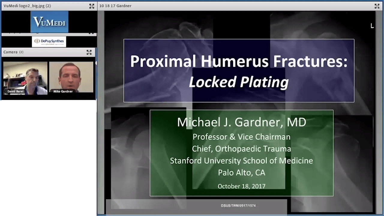 An image of the "Proximal Humerus Fractures - Locked Plating with Michael Gardner, MD" video on the JnJInstitute.com website.