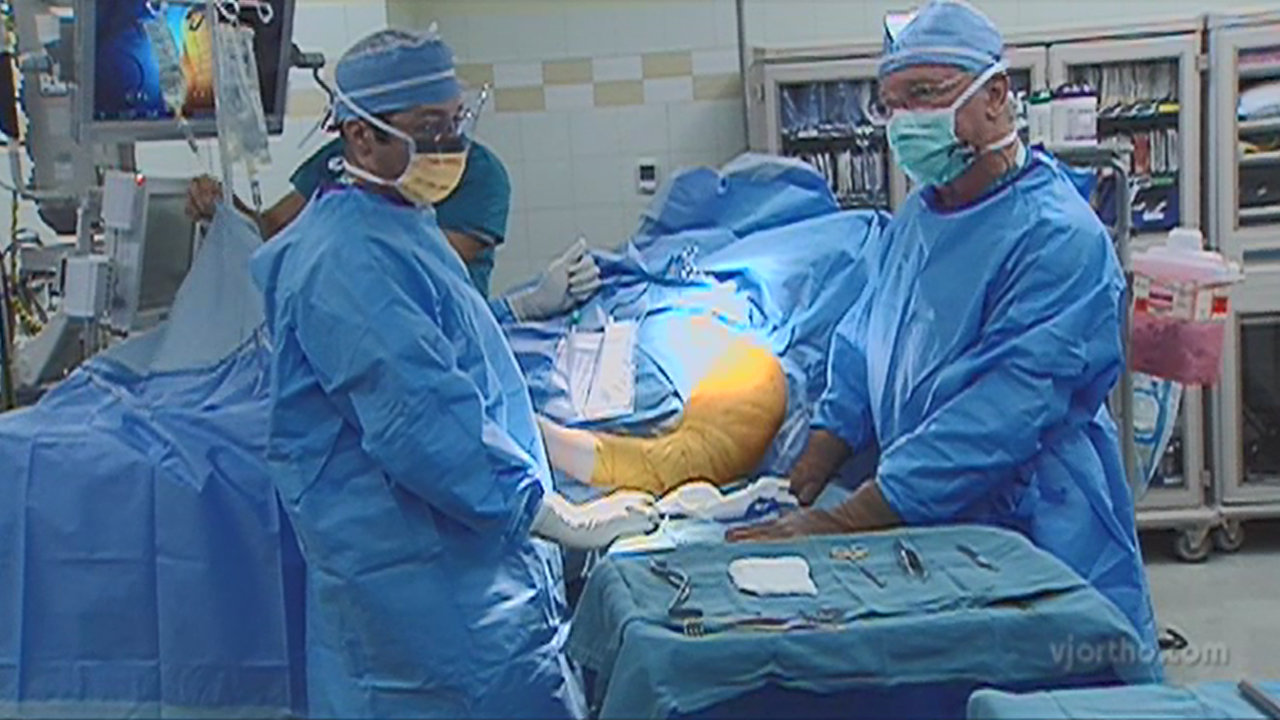 Image of the DELTA XTEND™ Reverse Shoulder System Surgery With Carl J. Basamania, MD video.