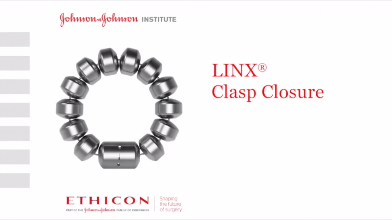 LINX Reflux Management System - Clasp Closure