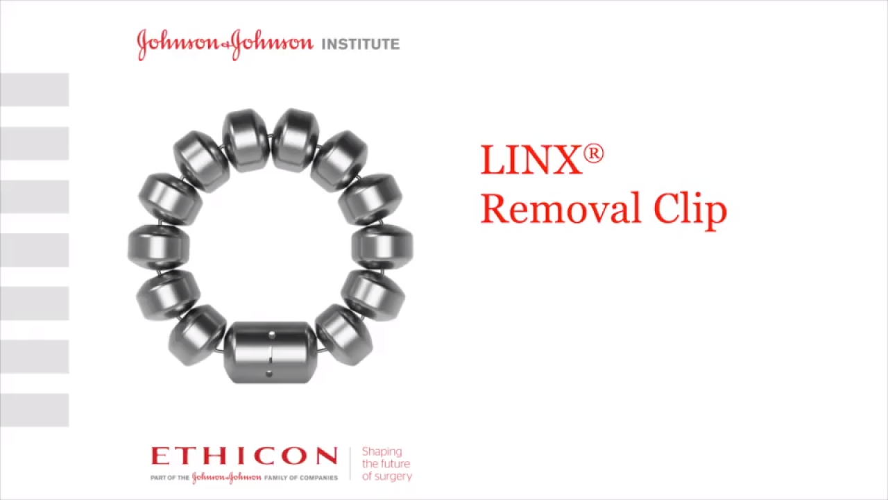 An image from the "LINX® Reflux Management System - Removal Clip" video on the JnJInstitute.com website.