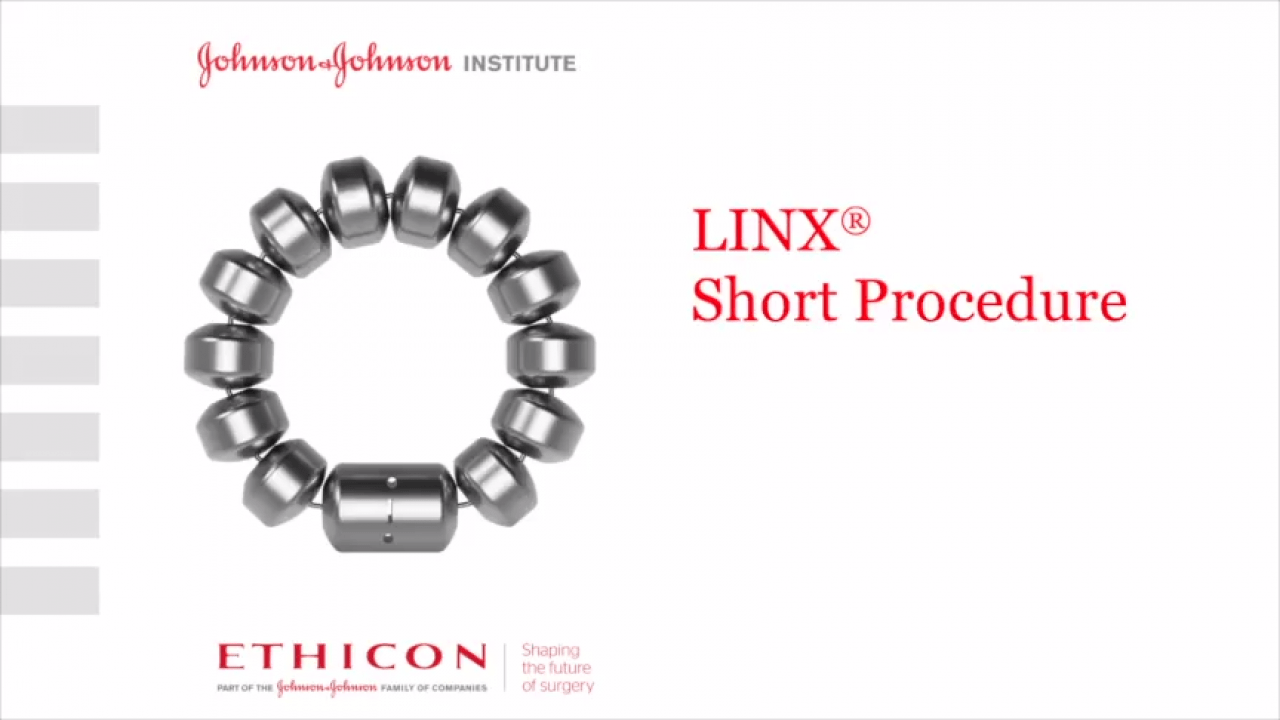 LINX® Reflux Management System - Short Procedure