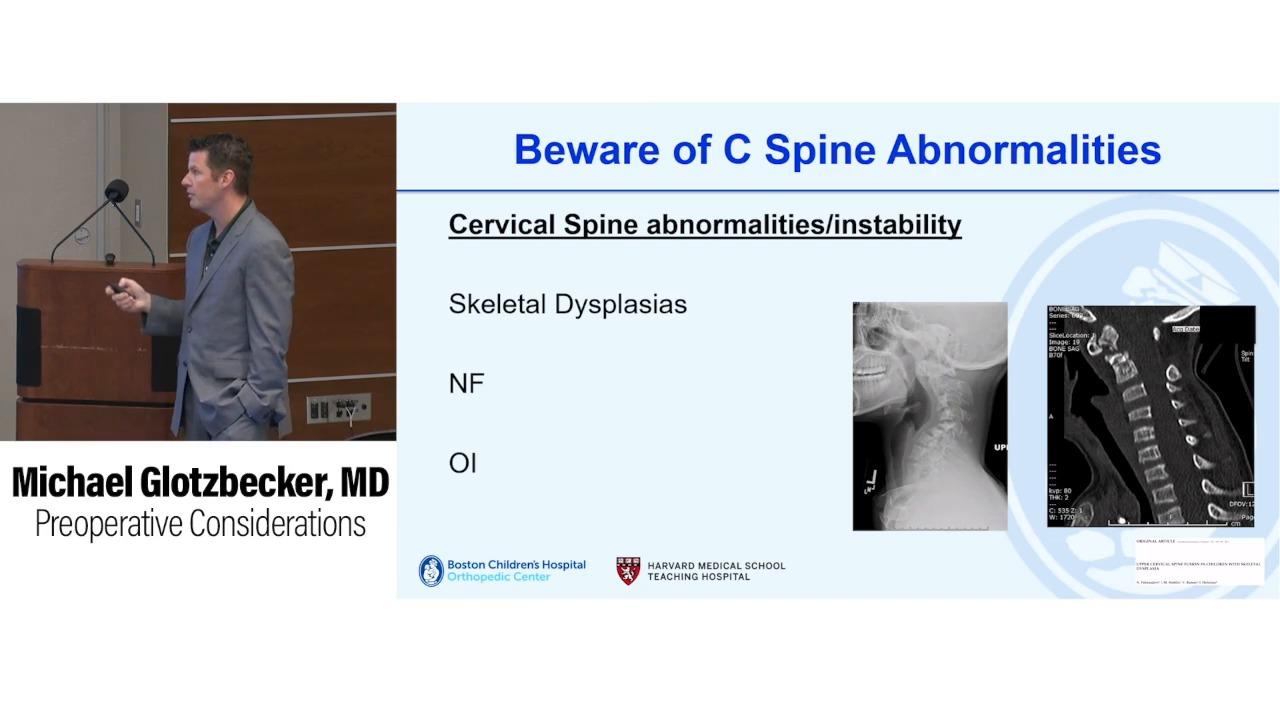 An image from the "Neuromuscular Scoliosis: Preoperative Considerations with Michael Glotzbecker, MD" video on the JnJInstitute.com website.