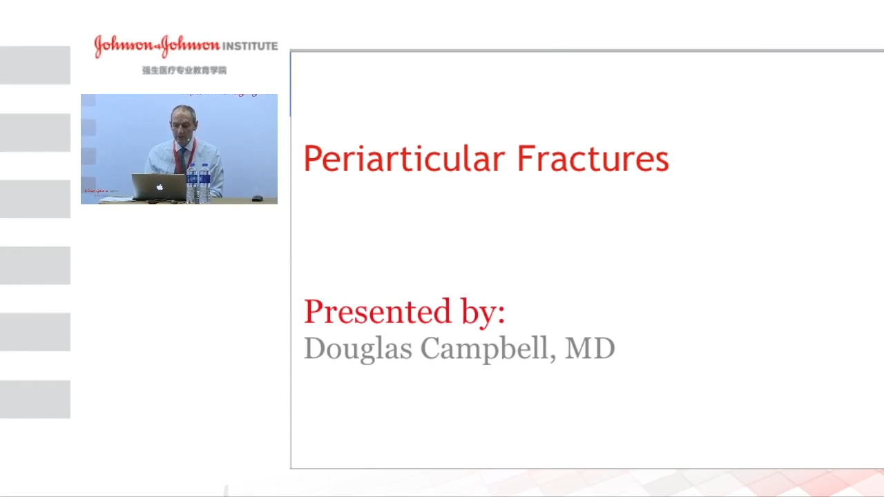 image of "Periarticular Fractures Overview with Douglas Campbell, MD" video on jnjinstitute.com
