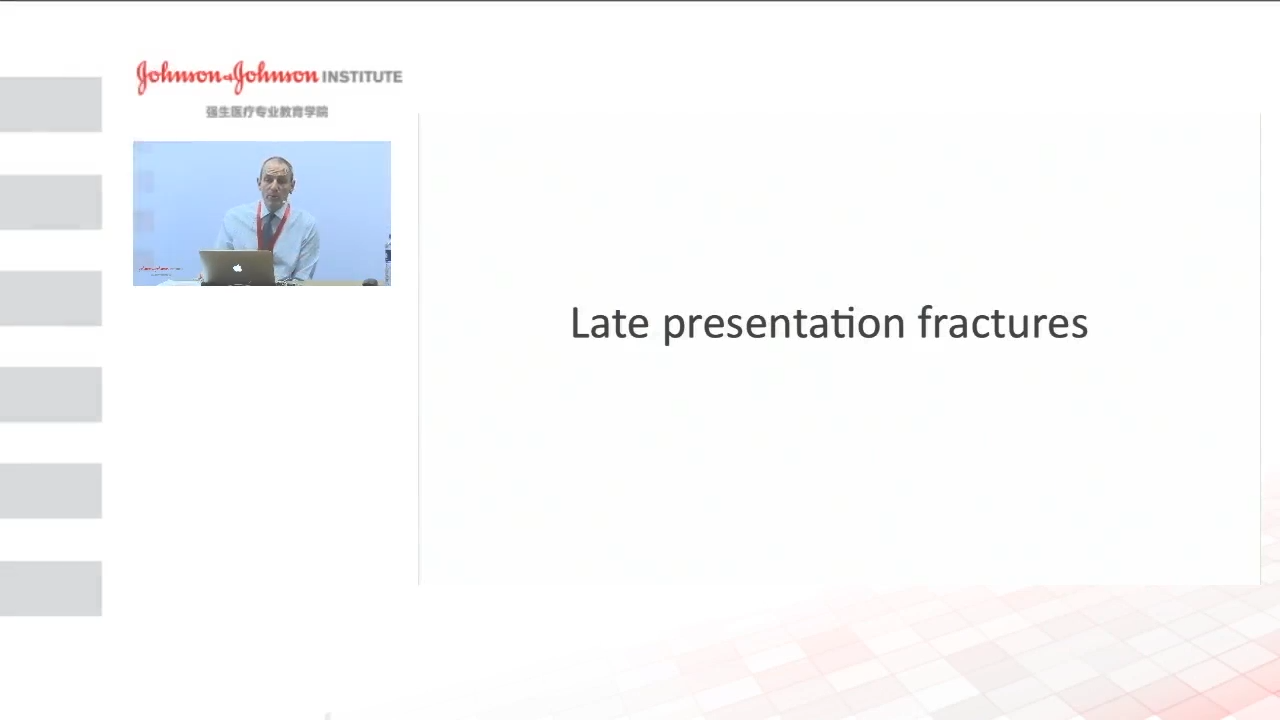 An image from the "Management of Late Presentation Fractures - Articular Osteotomy with Douglas Campbell, MD" video on the JnJInstitute.com website.