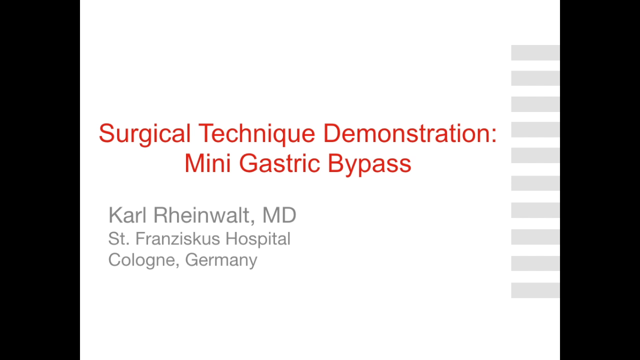 An image of the "Mini Gastric Bypass Surgical Demo with Karl Rheinwalt, MD" video.
