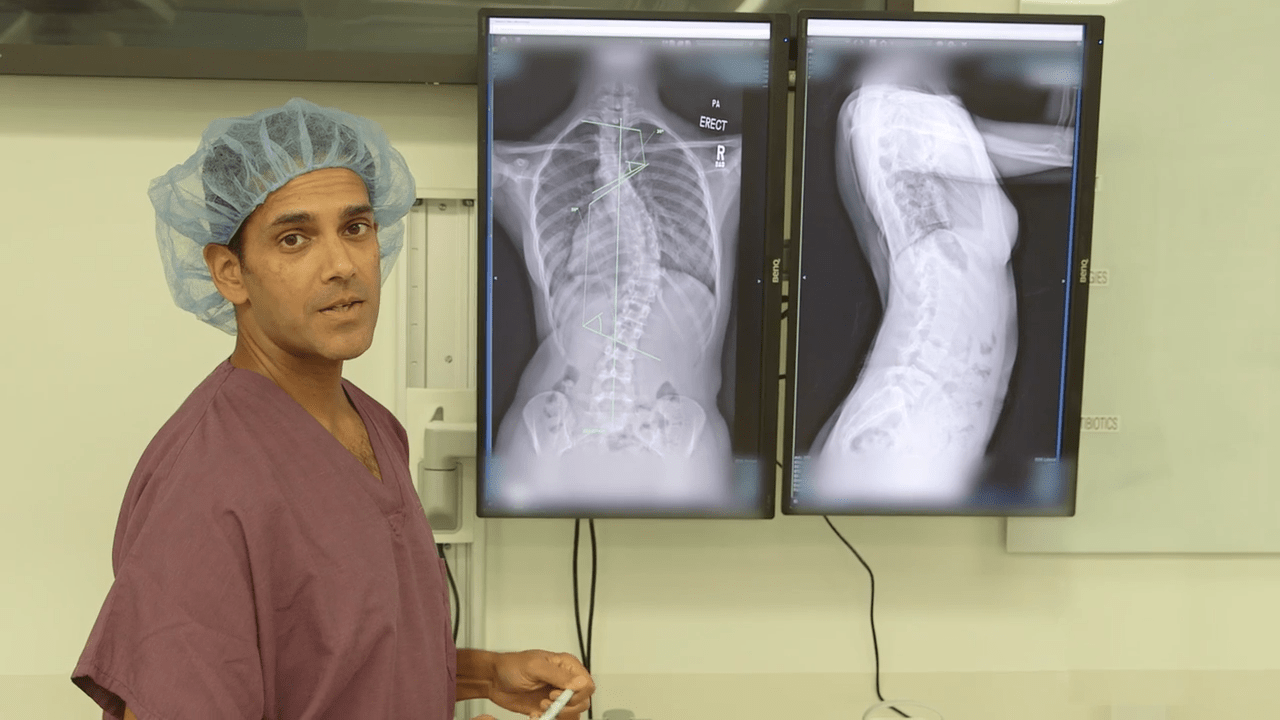 An image from the "Posterior Correction of Adolescent Idiopathic Scoliosis with Attention to Differential Rod Contouring with Dr. Suken A. Shah (Full Surgical Video)" video on the JnJInstitute.com website.