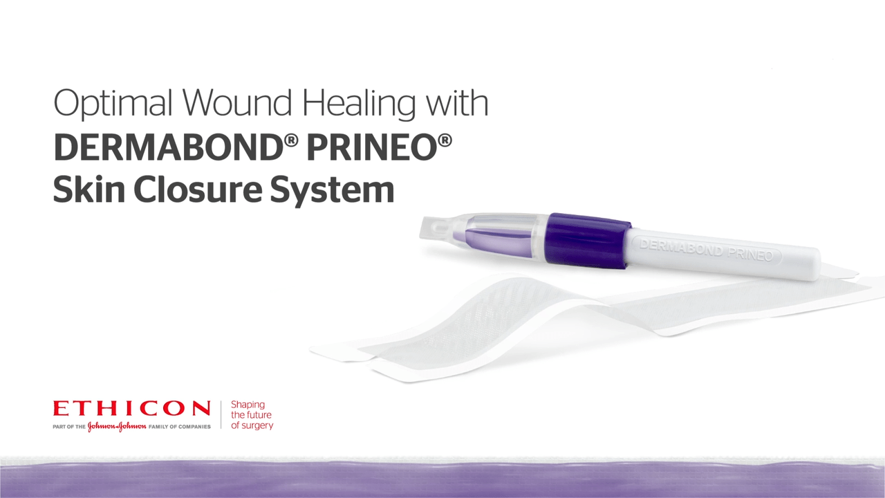 An image from the "Reducing Wound Drainage with New Skin Closure Systems by Liza Ovington, MD" video on the JnJInstitute.com website.