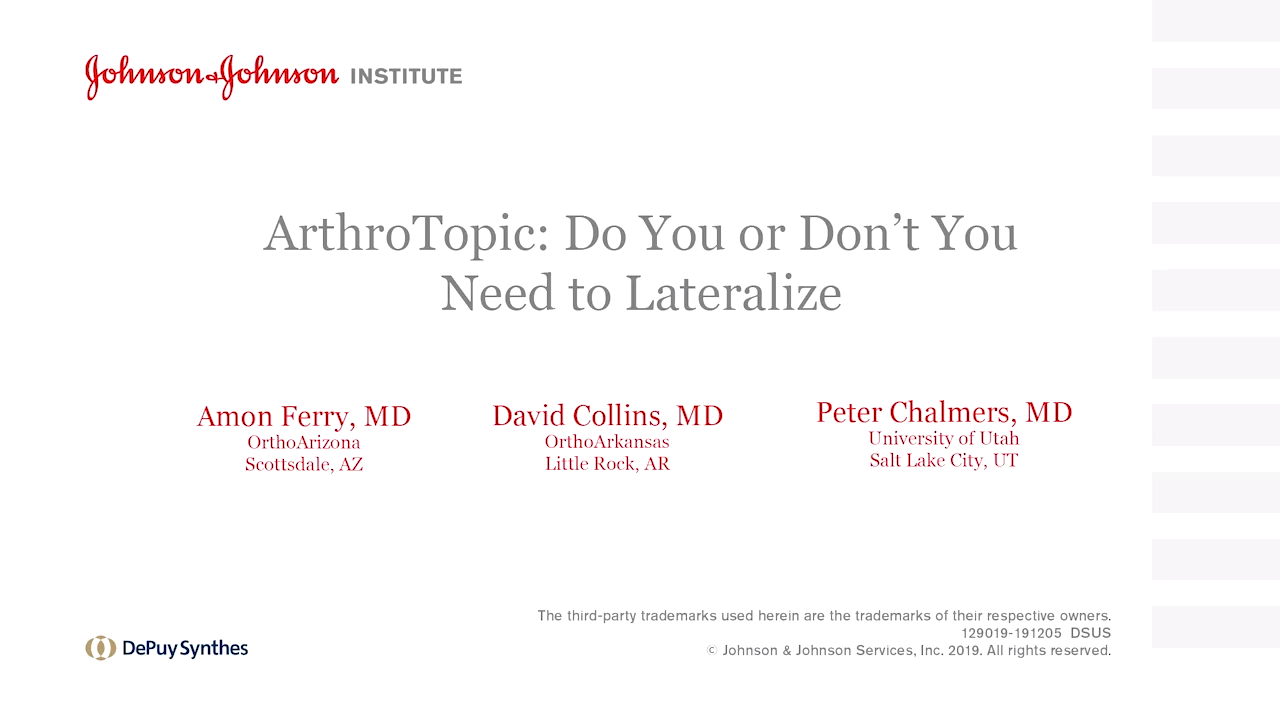 An image from the "ArthroTopic: Do You or Don’t You Need to Lateralize?" video on the JnJInstitute.com website.