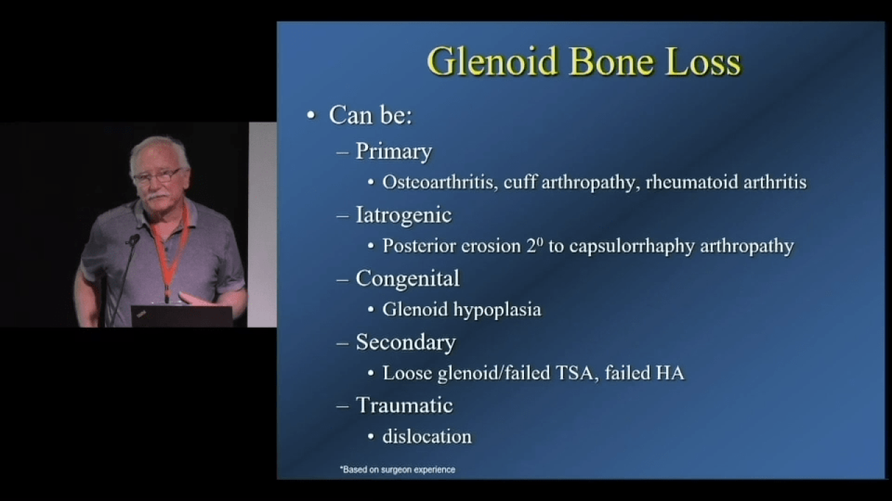 An image from the "Dealing with Glenoid Bone Loss in Total Shoulder Arthroplasty with Carl Basamania, MD" video on the JnJInstitute.com website.