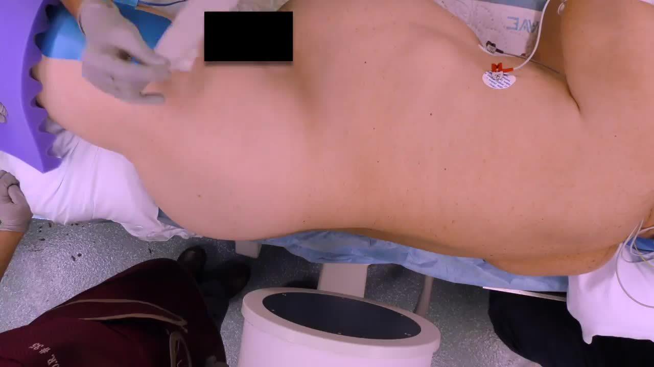 Anterior to Psoas (ATP): Patient Positioning with Chi Lim, MD
