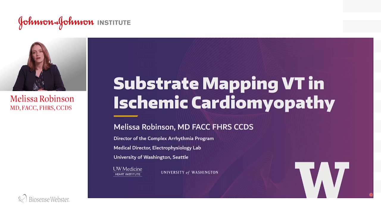 An image from the "Substrate Mapping in VT Ischemic Cardiomyopathy with Melissa Robinson, MD" video on the JnJInstitute.com website.