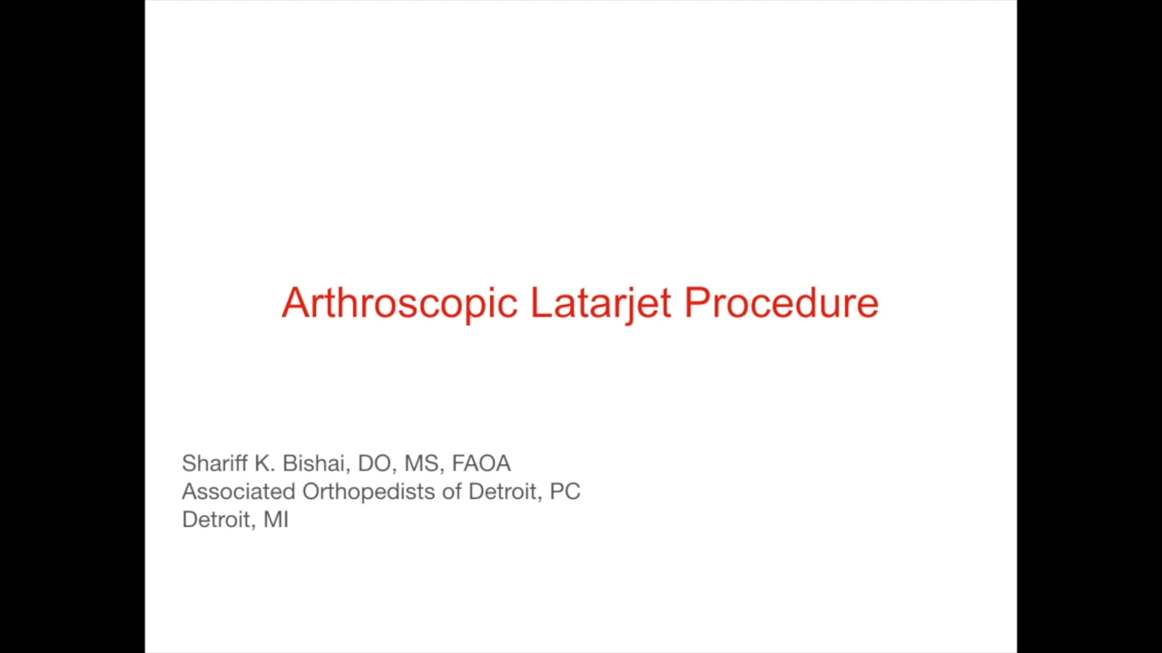 An image from the "Arthroscopic Latarjet Procedure with Shariff Bishai, DO, MS, FAOAO" video on the JnJInstitute.com website.
