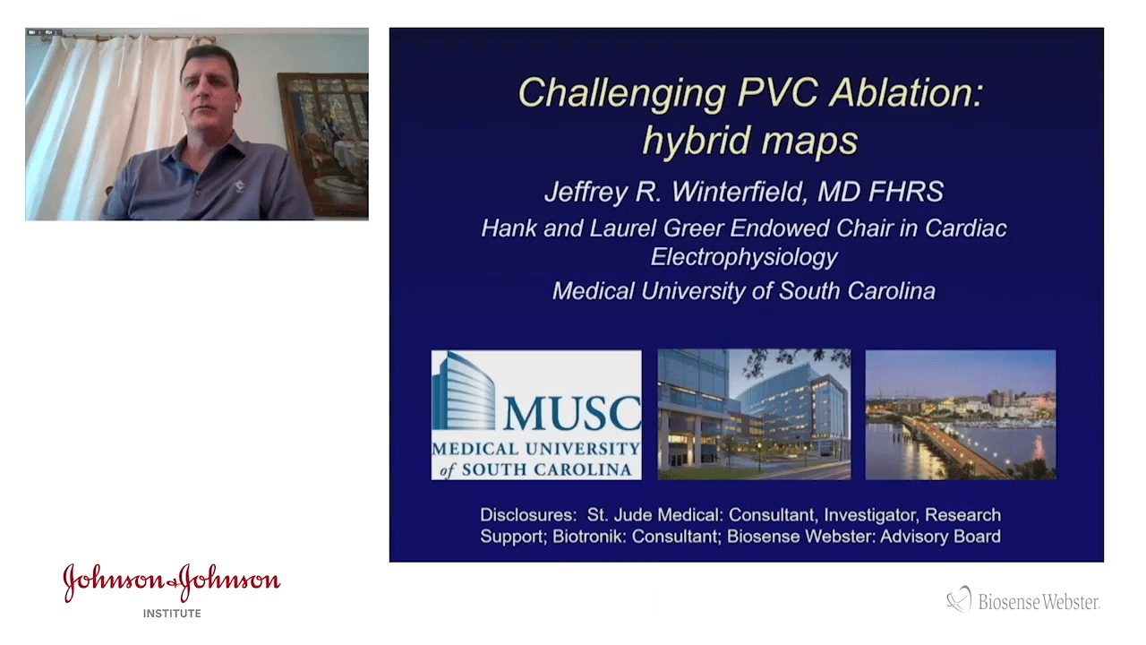 An image from the "CARTO®3 System V7 LAT Hybrid for PVC Mapping & Treatment with Gregory Winterfield, MD" video on the JnJInstitute.com website.
