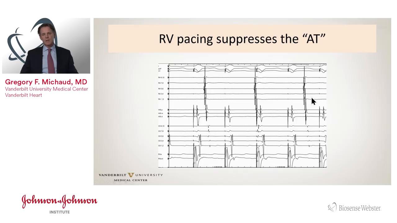 An image from the "Diagnostic SVT Maneuvers with Gregory F. Michaud, MD" playlist on the JnJInstitute.com website.