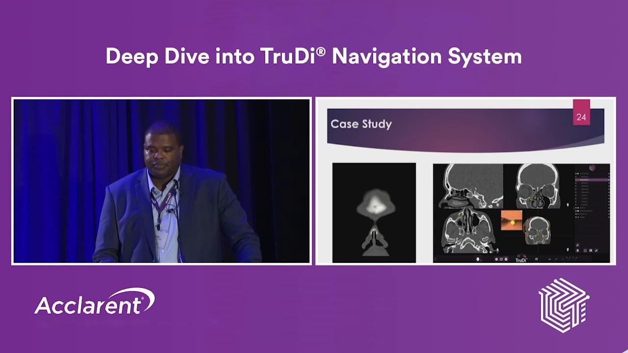 An image from the "Deep Dive into TruDi® Navigation System Functions" video on the JnJInstitute.com website.