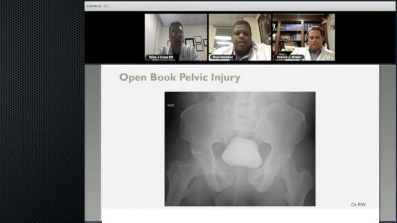 An image from the "The Utility of Continuous Compression Implants for Trauma Application: Pelvic Ring Fractures Case Presentation with Brian Cross, DO; Paul Gladden, MD; Patrick Wiater, MD" video on the JnJInstitute.com website.