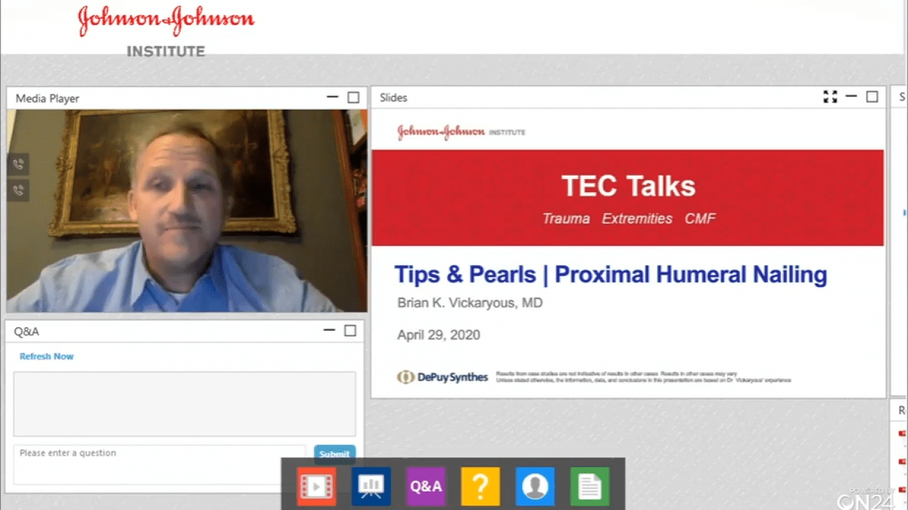 An image from the "TEC Talks: Tips & Pearls for Proximal Humerus Nailing with Brian K. Vickaryous, MD" video on the JnJInstitute.com website.