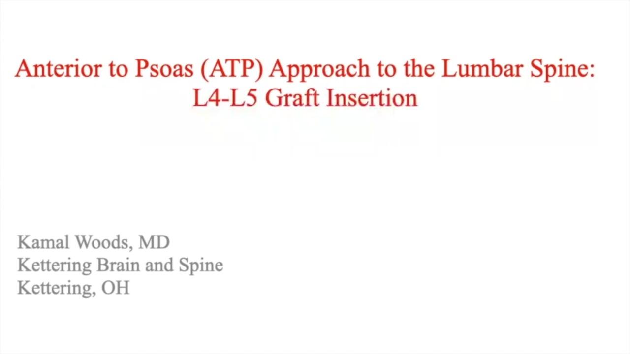 Anterior to Psoas (ATP) Approach to the Lumbar Spine: L4-L5 Graft Insertion
