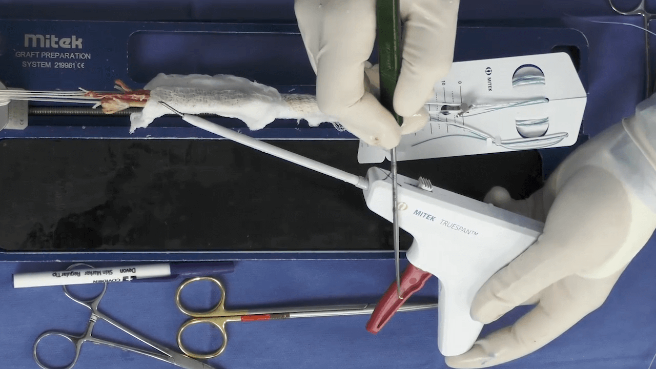 TRUESPAN Meniscal Repair System with Amir Moinfar, MD thumbnail
