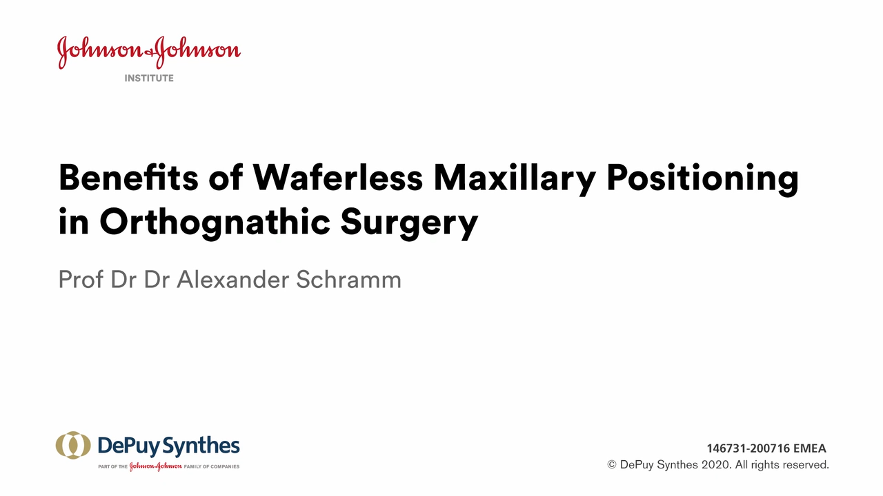 An image from the "Benefits of Waferless Maxillary Positioning in Orthognathic Surgery with Prof. Alexander Schramm, MD" video on the JnJInstitute.com website.