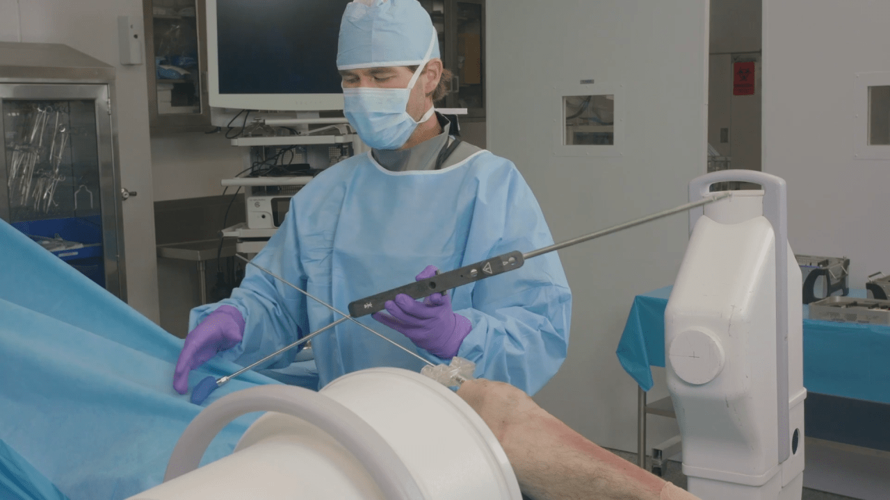An image from the "TFN-ADVANCED Tibial Nailing System: Suprapatellar Approach - Nail Insertion with Matthew Graves, MD" video on the JnJInstitute.com website.