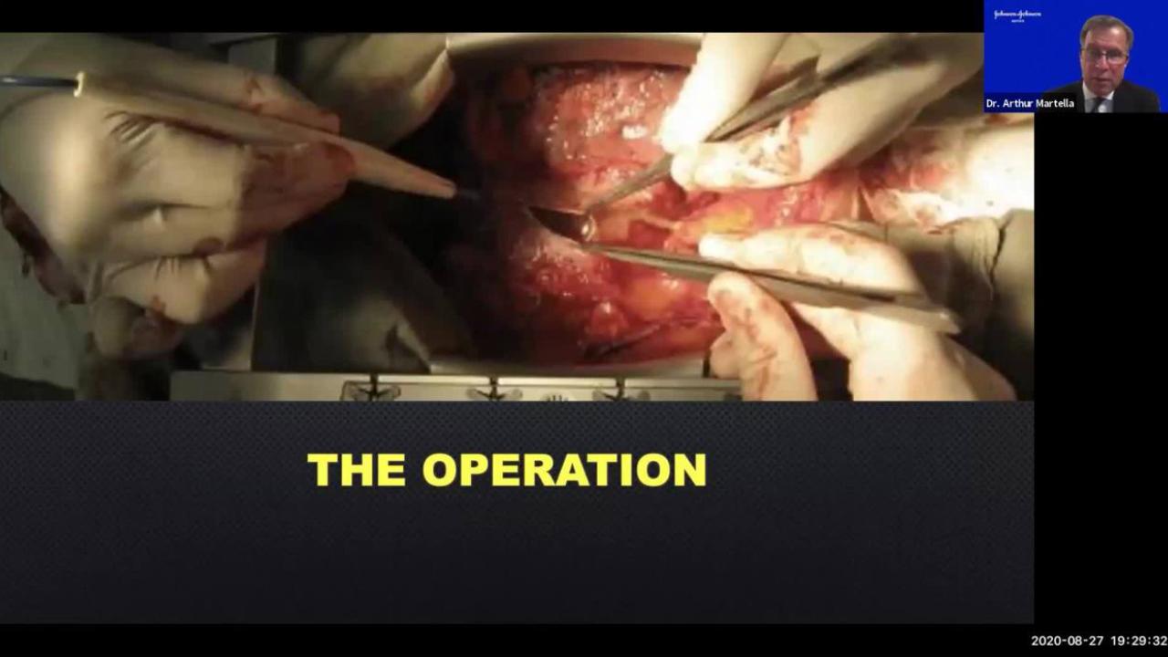 image of "Patient Blood Management in the COVID-19 World" video on jnjinstitute.com