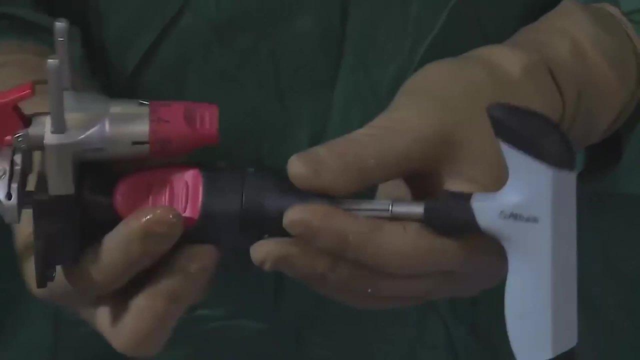 An image from the "Distal Femoral Resection with Robert Gorab, MD" video on the JnJInstitute.com website.