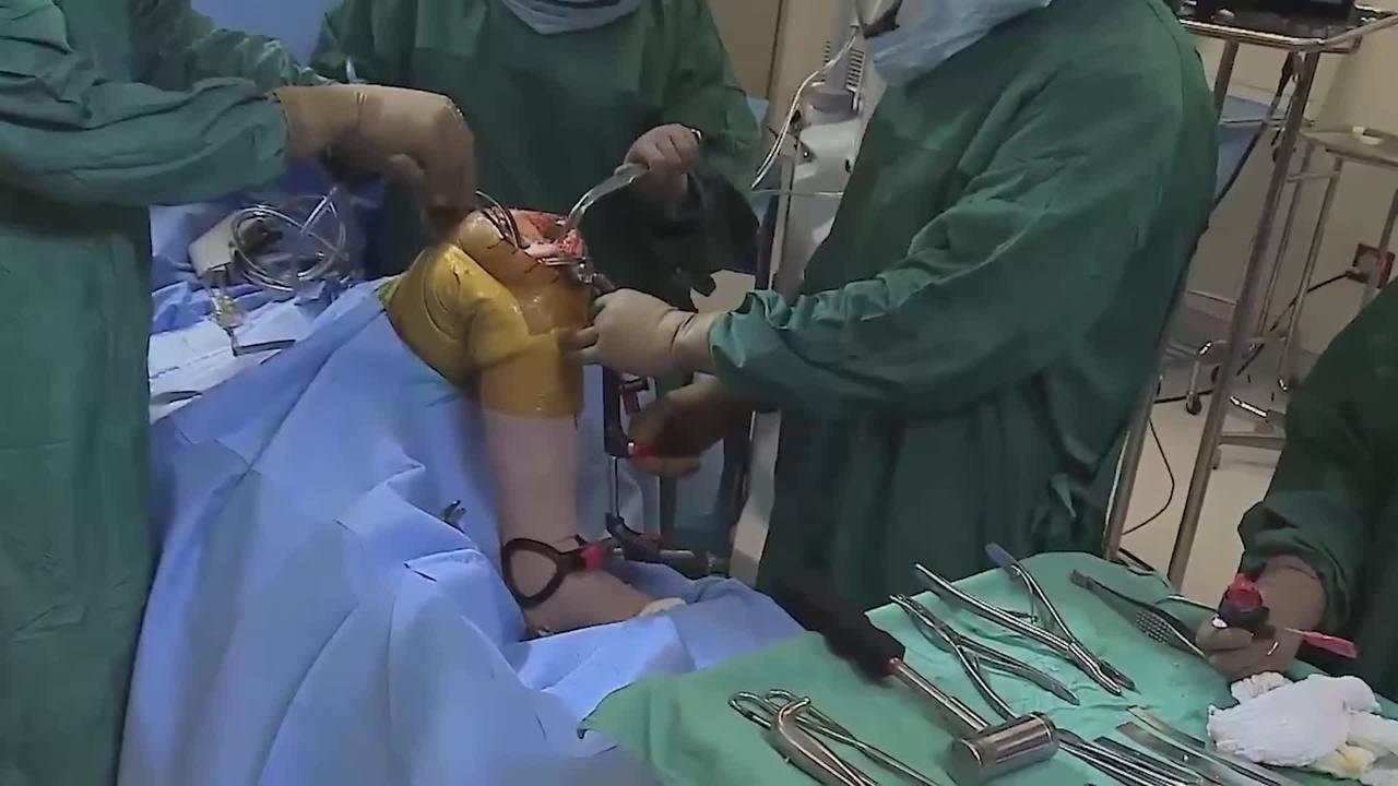 An image from the "Proximal Tibia Resection with Robert Gorab, MD" video on the JnJInstitute.com website.