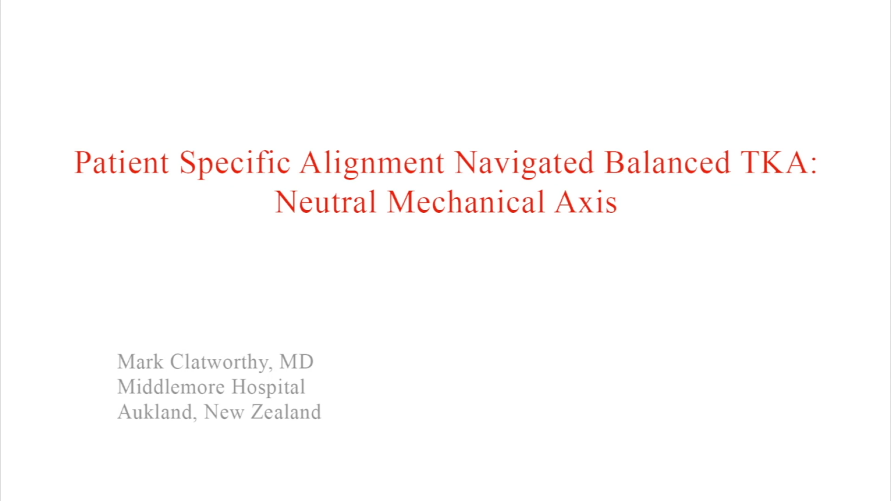 An image from the "Patient Specific Alignment: Tibia First Navigated Balance TKA Approach - Neutral Mechanical Axis" video on the JnJInstitute.com website.