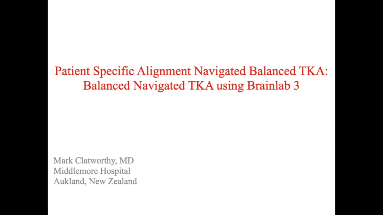 An image from the "Patient Specific Alignment: Tibia First Navigated Balance TKA Approach Balanced Navigated TKA with Brainlab" video on the JnJInstitute.com website.