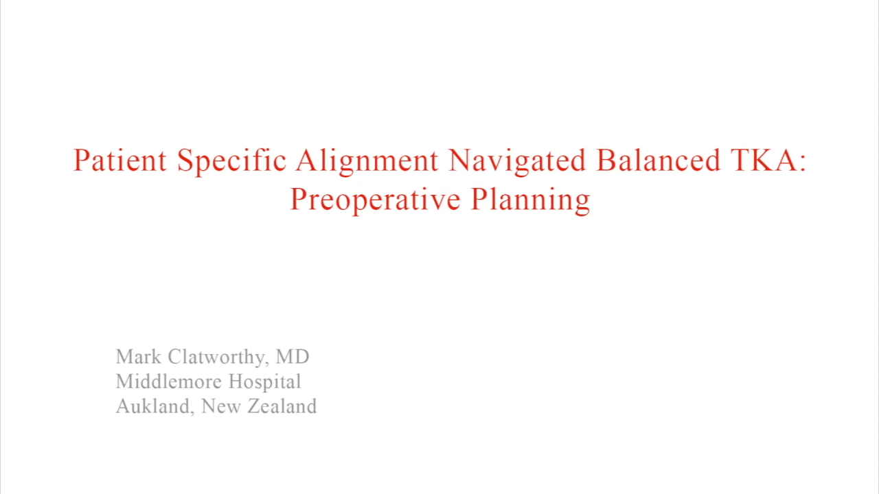 An image from the "Patient Specific Alignment: Tibia First Navigated Balance TKA Approach - Interoperative Planning" video on the JnJInstituet.com website.