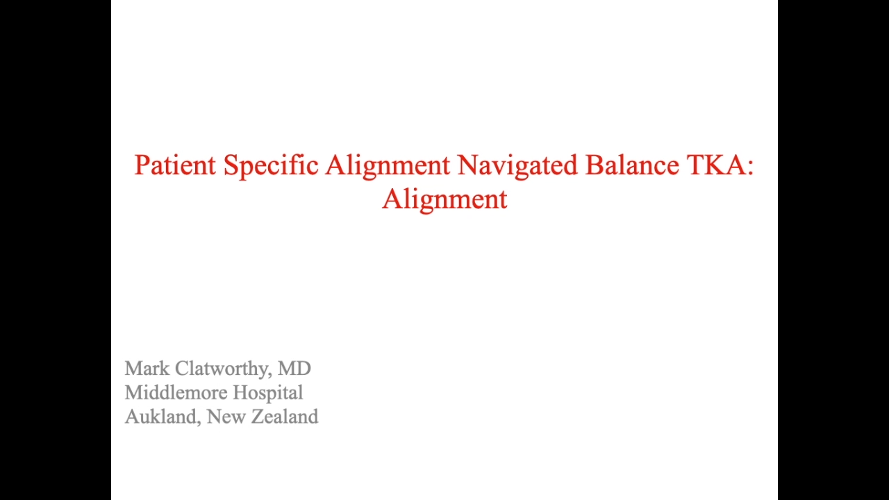 An image from the "Patient Specific Alignment: Tibia First Navigated Balance TKA Approach - Alignment' video on the JnJInstitute.com website.