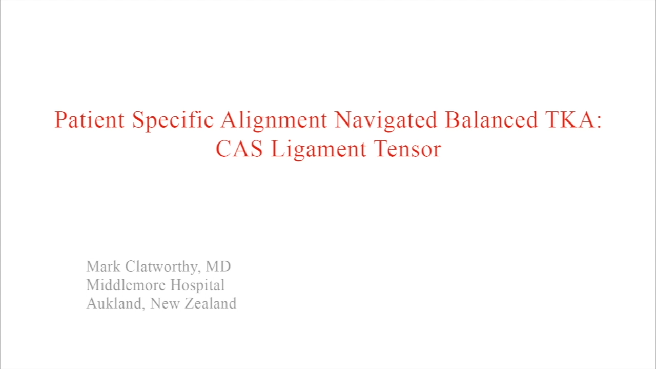 An image from the "Patient Specific Alignment: Tibia First Navigated Balanced TKA Approach - CAS Ligament Tensor" video on the JnjInstitute.com website.