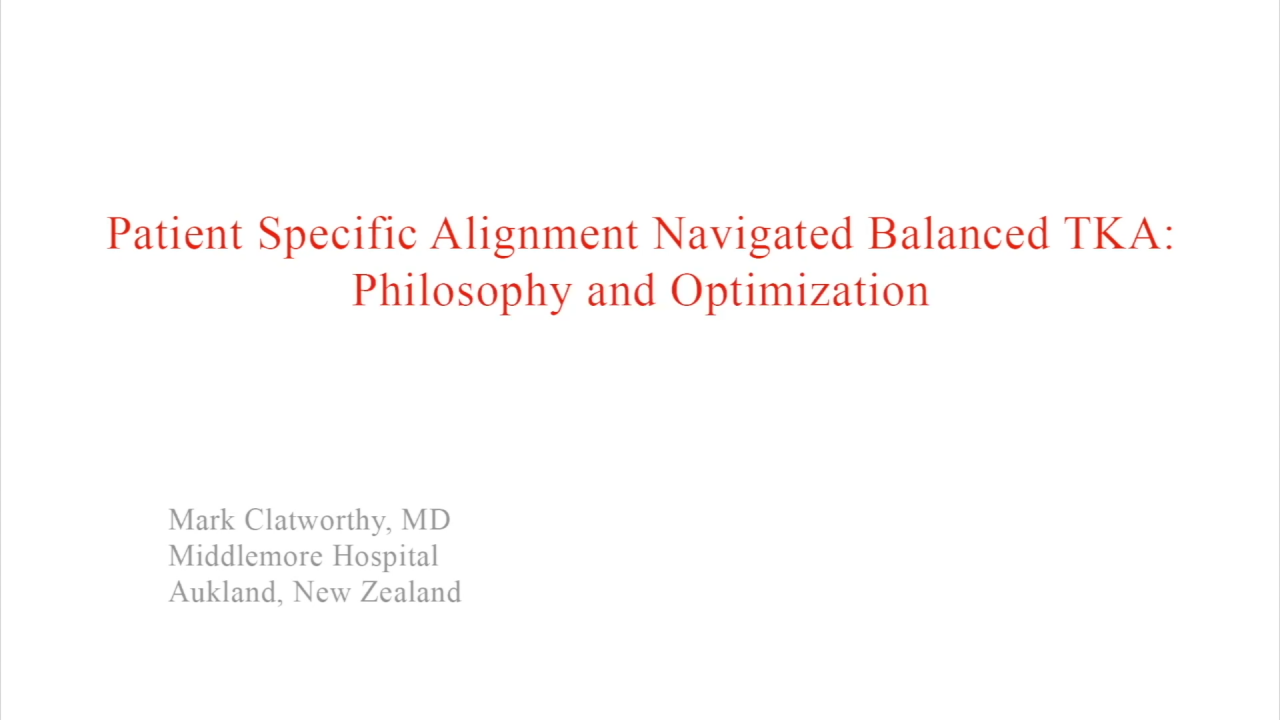 An image from the "Patient Specific Alignment: Tibia First Navigated Balanced TKA Approach - TKA Balance Philosophy & Optimization" video on the JnJInstitute.com website.