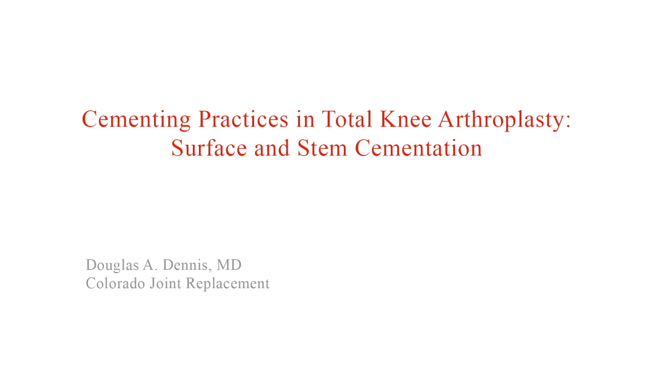 An image from the "Cementing Practices in Total Knee Arthroplasty: Surface & Stem" video on the JnJInstitute.com website.