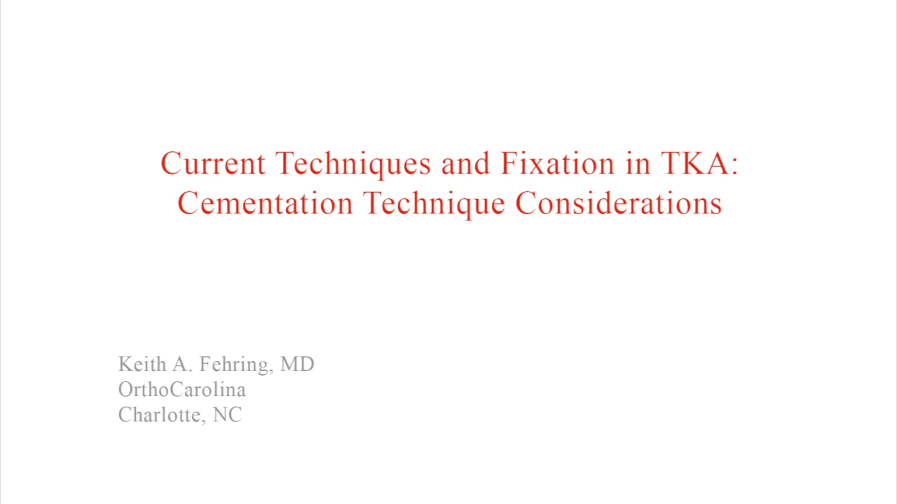 An image from the "Current Techniques & Fixation in Total Knee Cementation Techniques" video on the JnJInstitute.com website.