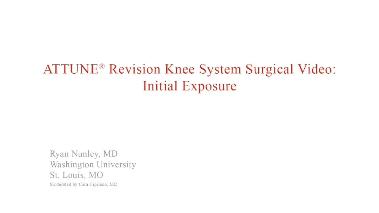 An image from the "ATTUNE Revision: Initial Exposure with Ryan Nunley, MD" video on the JnJInstitue.com website.