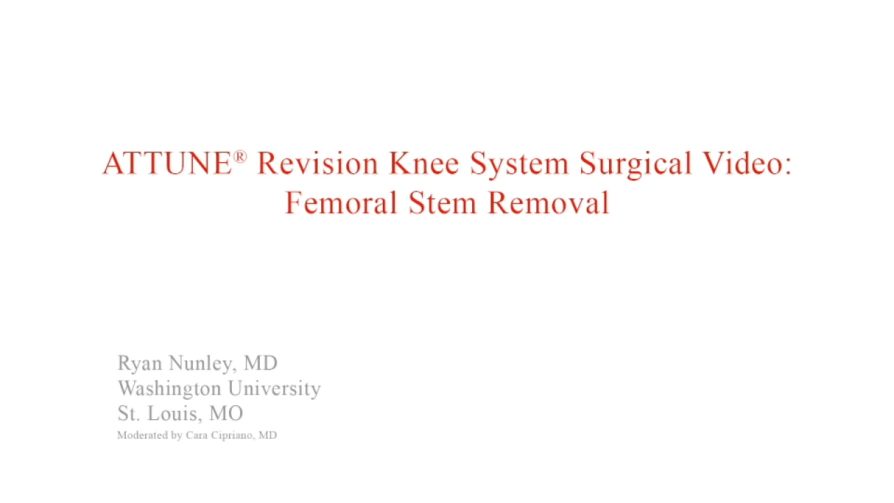An image from the "ATTUNE Revision: Femoral Stem Removal with Ryan Nunley, MD" video on the JnJInstitue.com website.