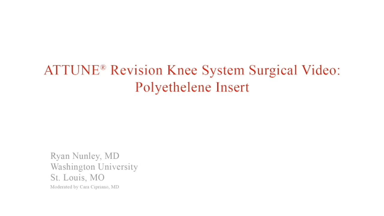 An image from the "ATTUNE Revision: Polyethylene Insertion with Ryan Nunley, MD" video on the JnJInstitute.com website.