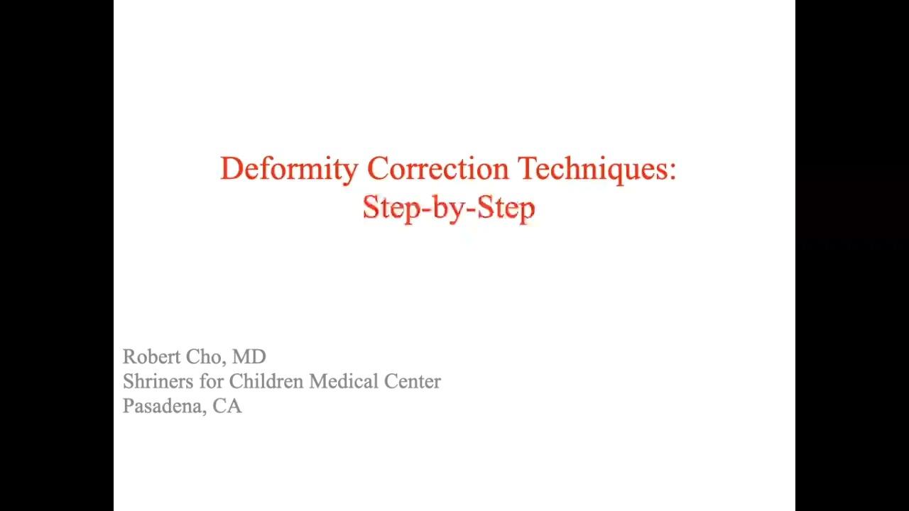 an image of "Deformity Correction Techniques: Step-by-Step with Robert Cho, MD" video on jnjinstitute.com