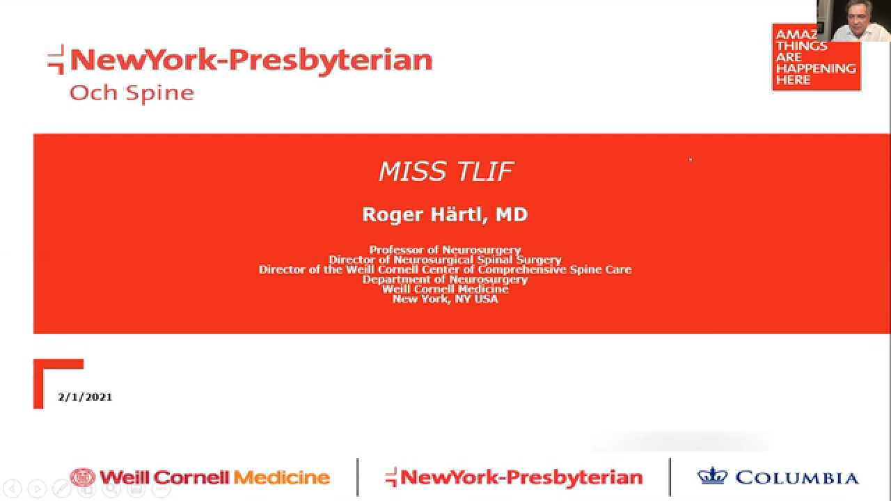 MIS TLIF: Workflow and Augmented Reality with Roger Hartl, MD thumbnail image