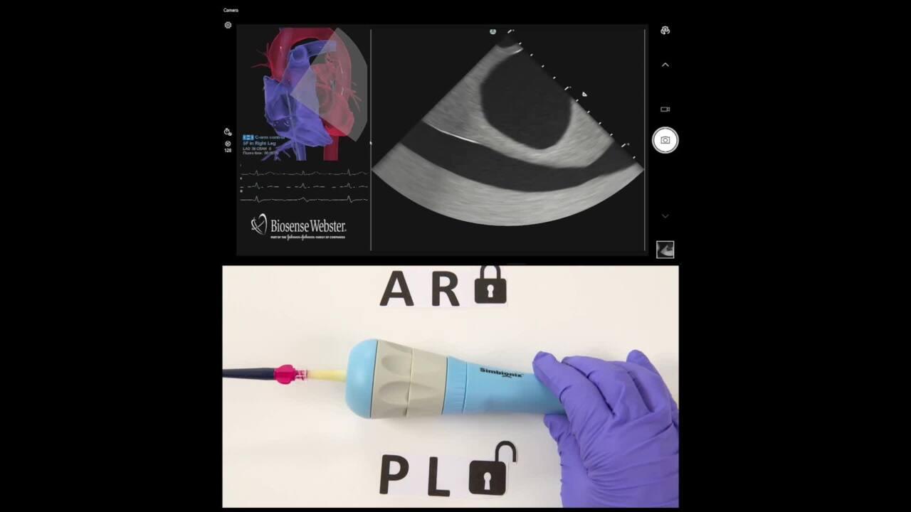 An Image From "ICE Catheter Manipulation"