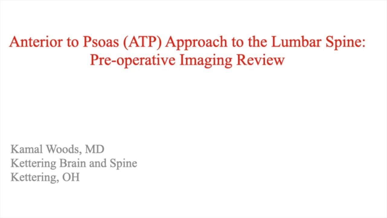 image from "Anterior to Psoas (ATP) Approach to the Lumbar Spine: Preoperative Image Review" video on jnjinstitute.com