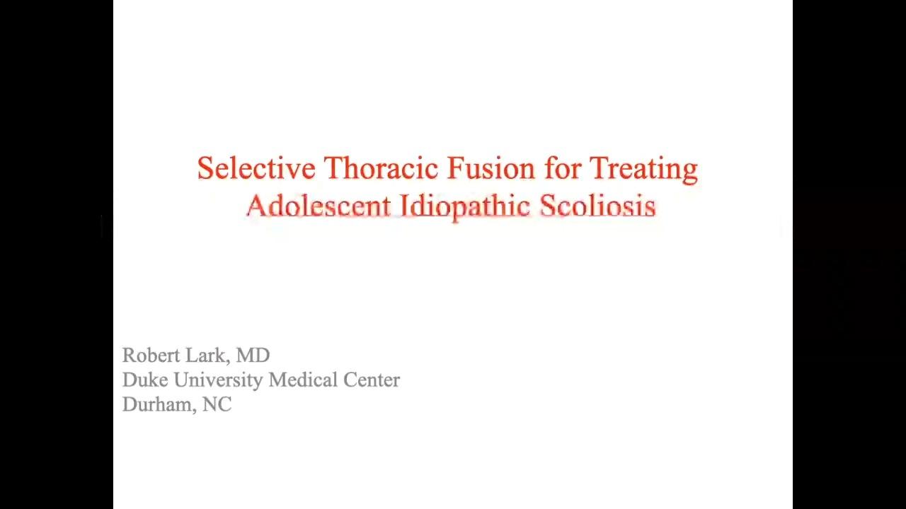 image from "Selective Thoracic Fusion for Treating Adolescent Idiopathic Scoliosis with Robert Lark, MD" video on jnjinstitute.com website