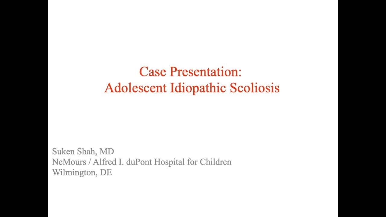 image from "Case Presentation: Adolescent Idiopathic Scoliosis with Suken Shah, MD" video on jnjinstitute.com website