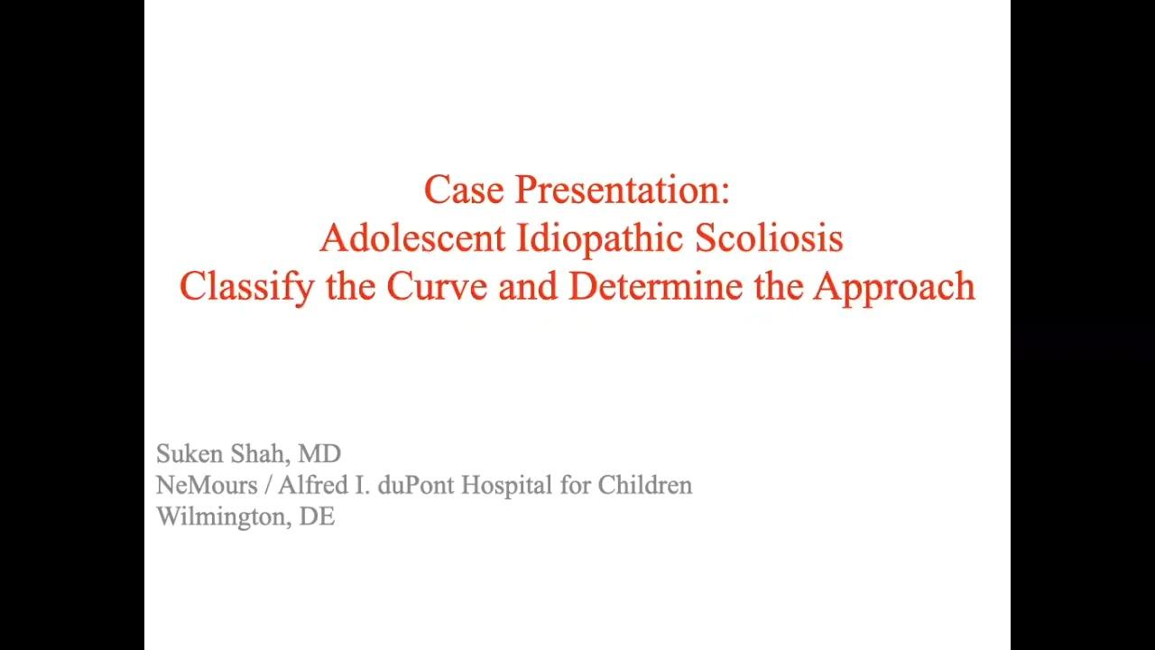 an image from "Case Presentation: Adolescent Idiopathic Scoliosis Classify the Curve and Determine the Approach with Suken Shah, MD" video on jnjinstitute.com